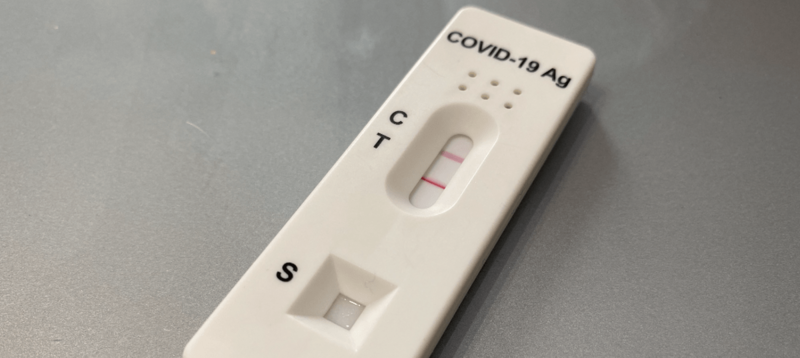 Imagen de archivo de un test de antígenos / TA